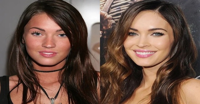  Here it turns out what changes famous stars have made to their appearance