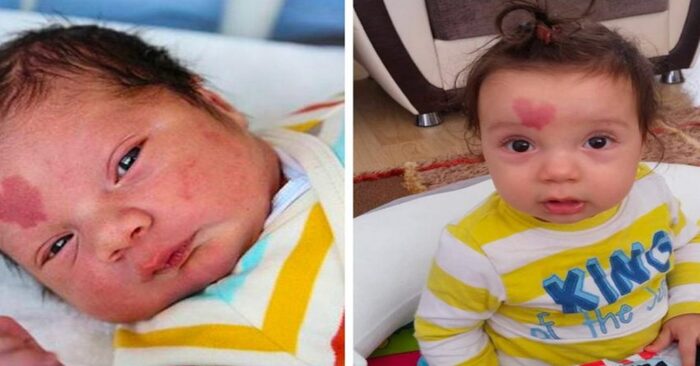  This wonderful baby was born with a unique heart mark on his forehead: this is what he looks like at the age of 6