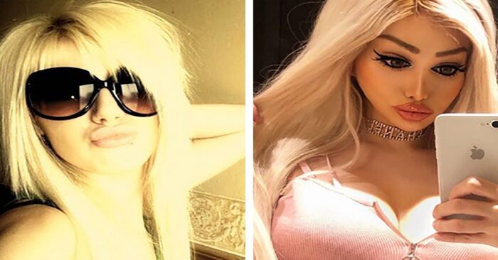  Sometimes people do everything to have a perfect appearance: this girl spent thousands of dollars to look like a doll