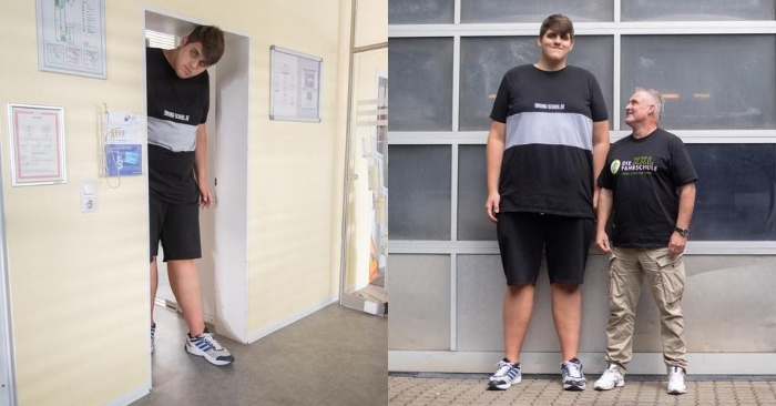  Shocking story: the height of this 19-year-old boy is 2 meters 24 centimeters, this is how he is