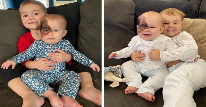  Sometimes babies are born with something special: this girl was born with a mark on her face