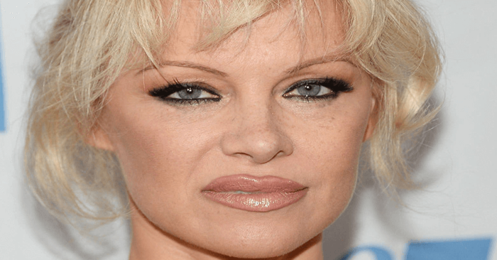  Plastic in new pictures: there is no trace of the former beauty of Pamela Anderson