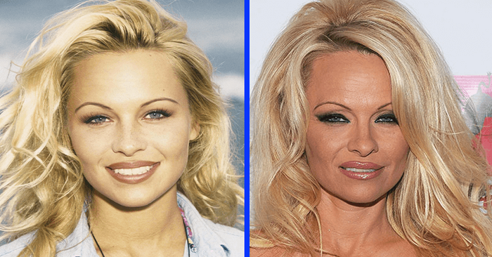  Fading beauty: fans don’t recognize Pamela Anderson, she looks like an old lady