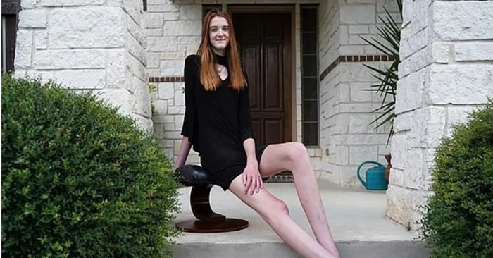  Unrealistically long legs: this unique girl has the longest legs in the whole world