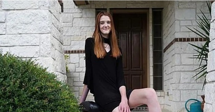  Unreal legs: this totally unique girl has the longest legs in the world which surprise everyone