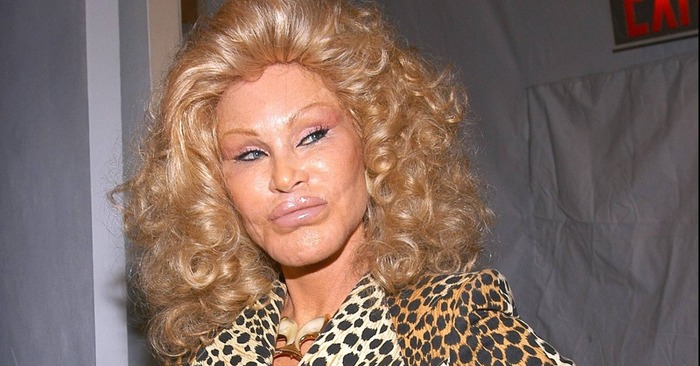  However, a beautiful woman has changed: this is how the woman looked before plastic surgery