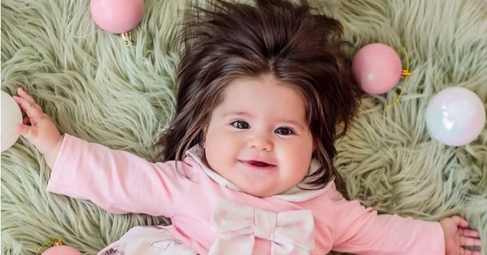  This is interesting: this is how a unique baby who was born with thick hair looks now