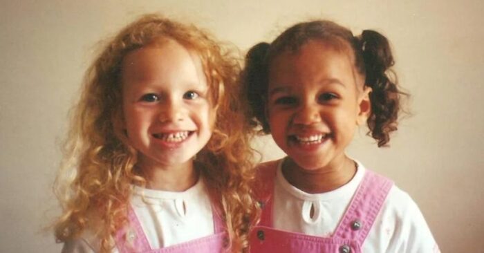  Interesting story: twins were born with different skin colors and this is what they look like 20 years later