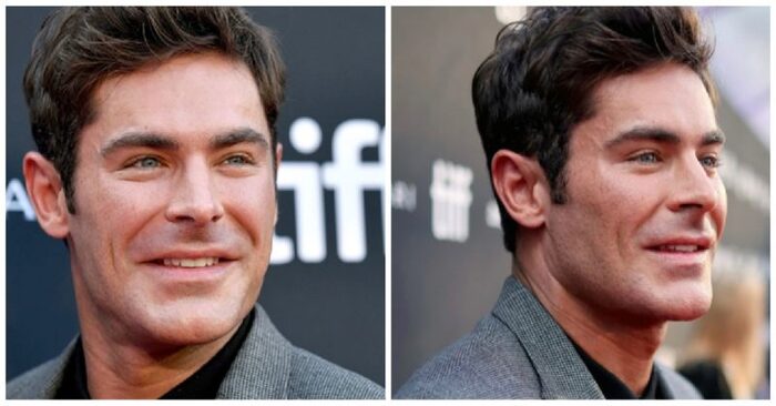 It is not known true or not: Zac Efron told what is the reason for his facial deformity