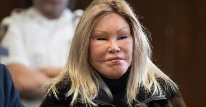  Real cat: this is what a woman with an unusual appearance looked like before plastic surgery