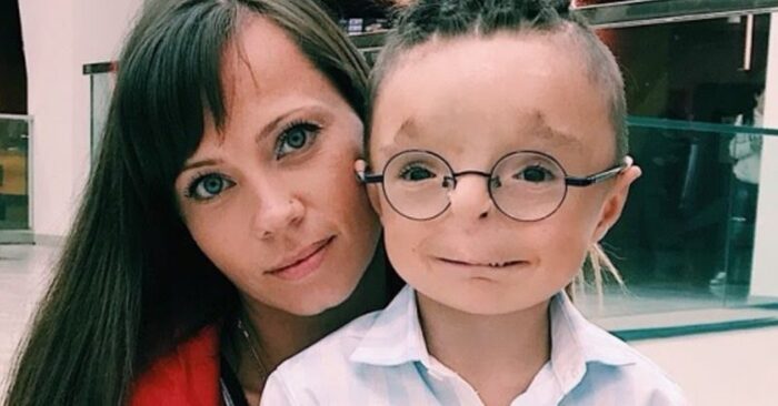  A touching story: a kind woman adopted a boy who was not wanted to be adopted and here he looks now