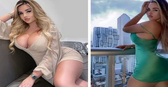  From simpleton to model. Look at Kvitko’s photos before and after plastic surgeon