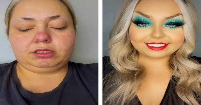  “Magical transformation!” Look how this blogger without teeth became a princess