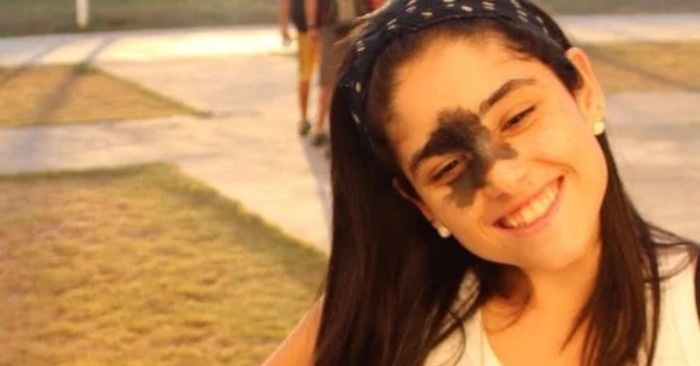  «Birthmark was the highlight of this girl»: this pretty girl changed the standards of beauty with her birthmark
