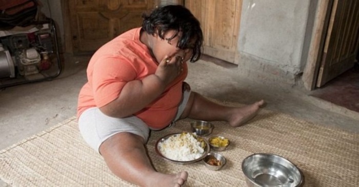  An amazing case of this girl: a nine-year-old child was with indefatigable appetite and weighing 92 kilograms