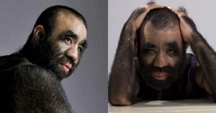  It seems that King Kong is real: the world’s hairiest man is listed in the Guinness Book of Records