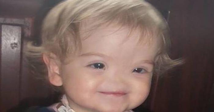  “She was born without a nose”. This is what looks like this baby girl today