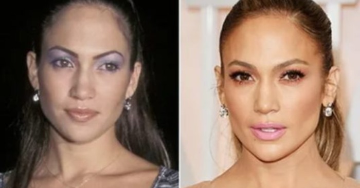  «Natural beautiful stars»: celebrities who have repeatedly proven to everyone that they didn’t do plastic