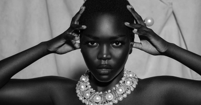  «Unique beauty conquers the whole world»: a girl with a rare skin color has become a model