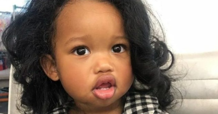  «This is how the girl looks today»: the baby became famous for her incredibly plumpest lips