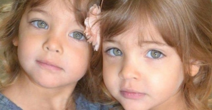  «Angel-like sisters years later!»: This is how the twins who stunned the world