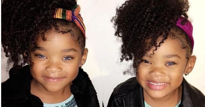  «Nature created a masterpiece!»: The parents showed what their unusually beautiful twins look like years later