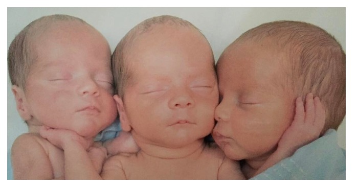 «One in 200 million births!»: In 2015 three identical triplets were born and here are the boys 8 years later