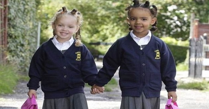  «What a phenomenon!»: Here are the unusual siblings with a different skin color years later