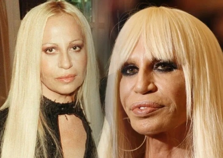 «Exclusive photos before surgeries!»: Only few know what Versace looked ...