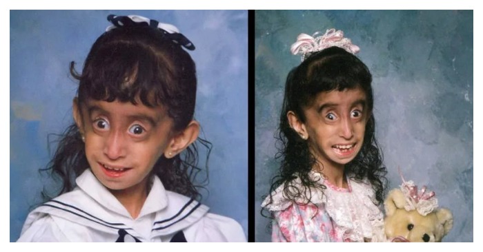 «People call her the ugliest girl on our planet!» This is what the unusual girl called «an ugly duckling» looks like now