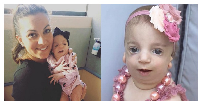  «Her arrival was not celebrated» Parents share heartbreaking reaction to their newborn baby with a rare genetic condition