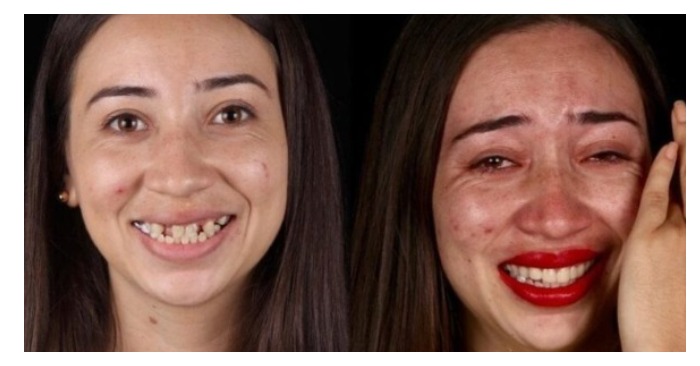  «From beggars to Hollywood stars!» A surprising photo series showing that a beautiful smile is the number one key to confidence