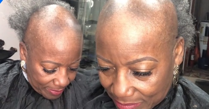  «From bald head to a real masterpiece!» The stylist turned a bald woman into a beauty