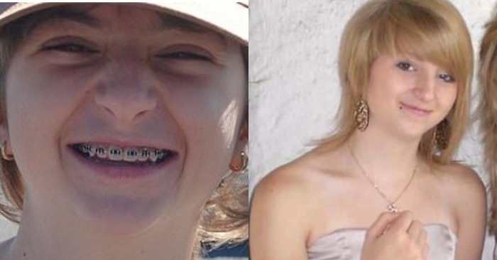  «From ugly duckling to hottie!» The girl was teased so much that she changed her appearance completely