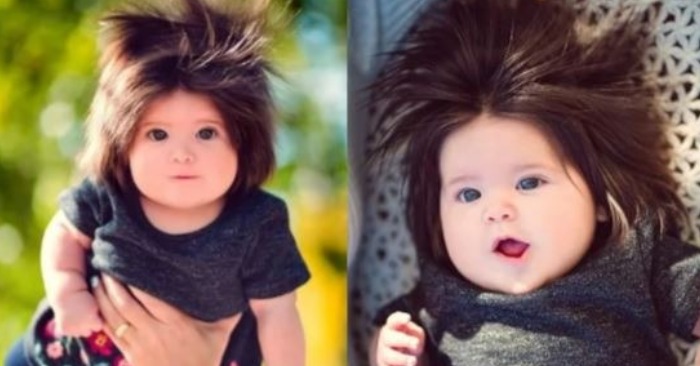  «She was born with thick hair!» Here is what the girl looks like now after becoming popular in the world