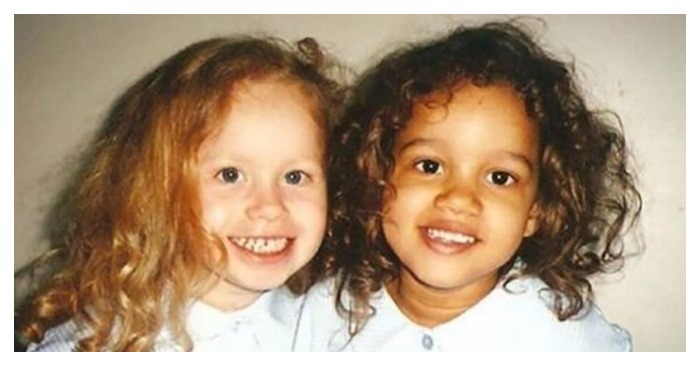  «A miracle or a rare phenomenon!» This is what the unique sisters with different skin colors look like over 20 years later