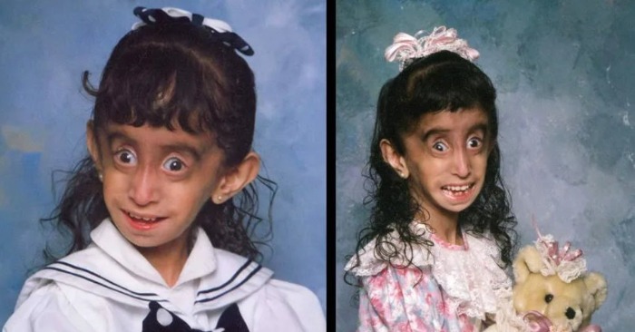  The incredible story of the world’s ugliest girl lets no one remain indifferent