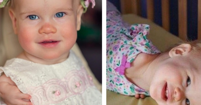  No one gave a second thought to adopt this unique baby, until one family gave her a second chance to a happy life