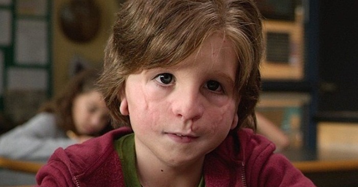  Auggie from «Wonder» behind the scenes! This is what Jacob Trembley looks like today