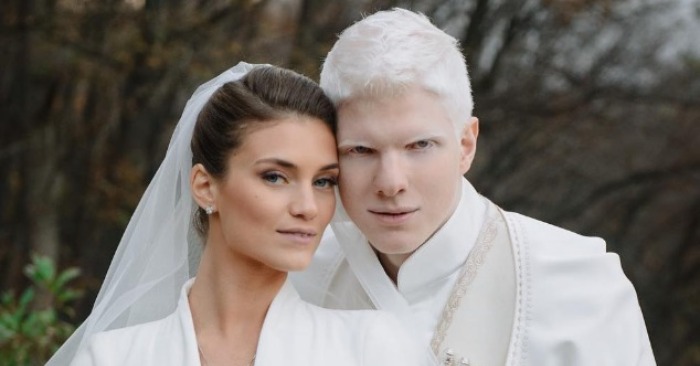  «A future supermodel!» The most handsome Albino singer showed his heir and blew up the network