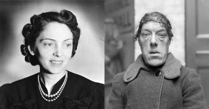  «The ugliest woman: Inside her tragedy» The incredible life story of Mary Ann that far not everyone knows