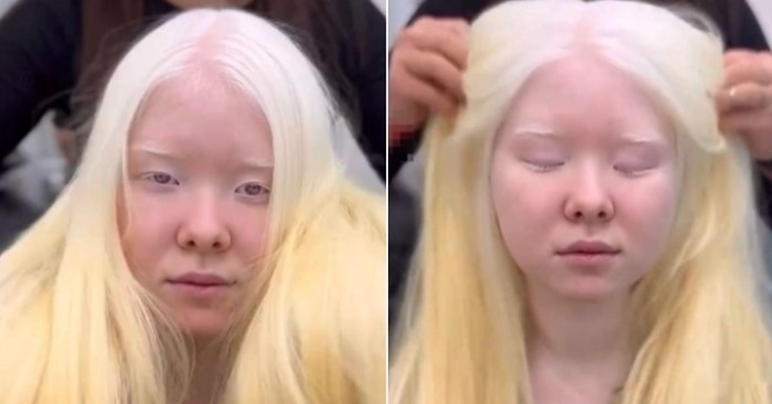  «What a fantastic transformation!» One Albino girl showed herself after a makeover and blew up the network
