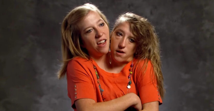  «Two sisters, one husband!» The conjoined twins showed their partner and blew up the network