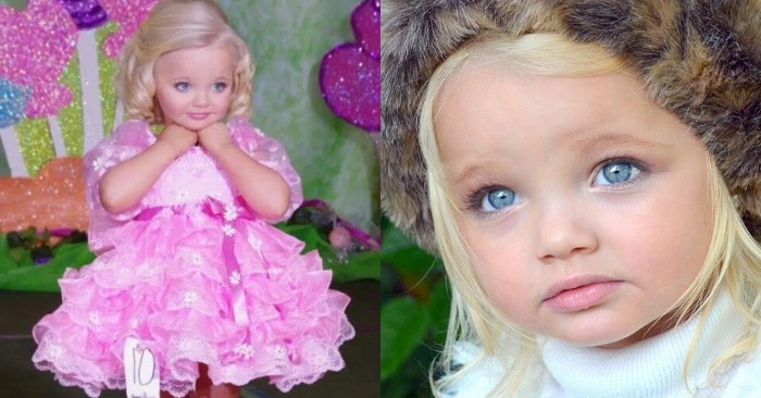  «The girl with a doll face has grown up!» This is what happened to the world’s most beautiful child