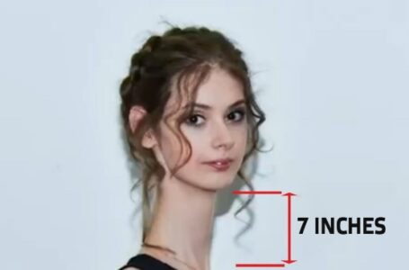 «The longest neck in the world!» The incredible life story of this absolutely unique girl is making headlines